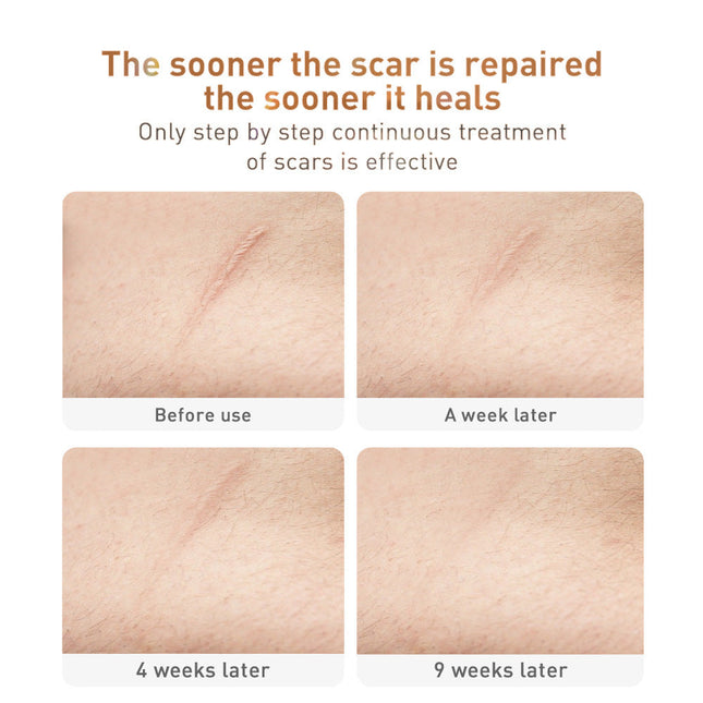 Herbal Repair Gel for Scar Removal
